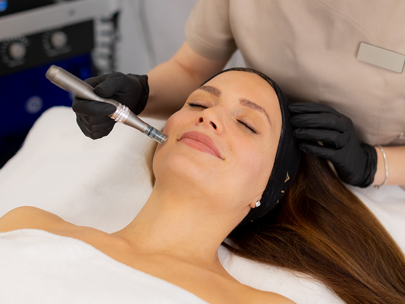 A woman receiving a microneedling treatment